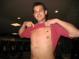 0506_blog_scar-thumb-547x410-11248911